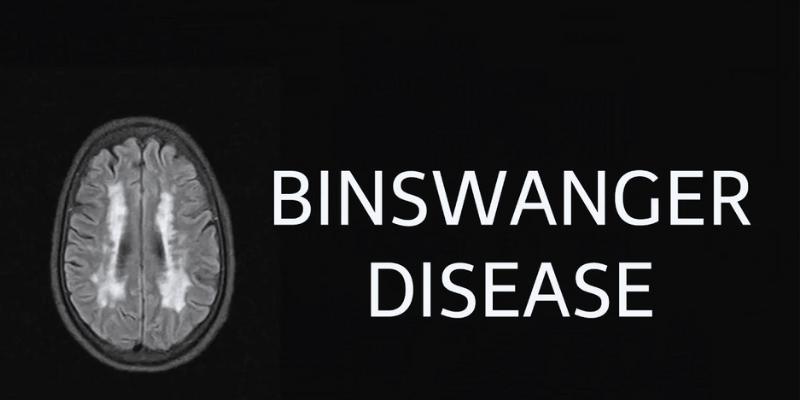 Managing and Treating Binswanger's Disease: A Comprehensive Guide